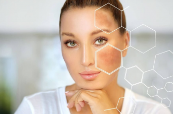 Effective Skincare and Lifestyle Tips to Fade PIH Naturally Effective Skincare and Lifestyle Tips to Fade PIH Naturally