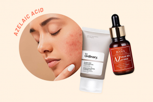 How to Use Azelaic Acid Safely for Rosacea-Prone Skin