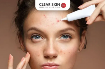 How Long Does It Take to Get Rid of Acne? A Dermatologist’s Guide to Clearer Skin How Long Does It Take to Get Rid of Acne? A Dermatologist’s Guide to Clearer Skin