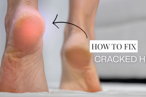 How to Transform Cracked Heels for Sandal Season | Exfoliating Foot Treatment