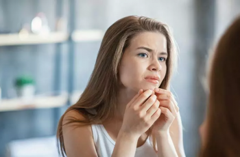 How to Get Rid of Acne: 8 Natural Treatments for Pimples