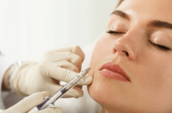 Do Dermal Fillers Work for Acne Scars? Expert Breakdown